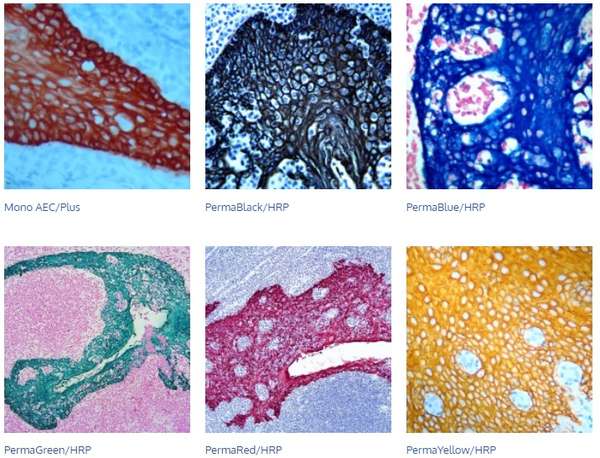 inmunohistoquimica-cromogenos1