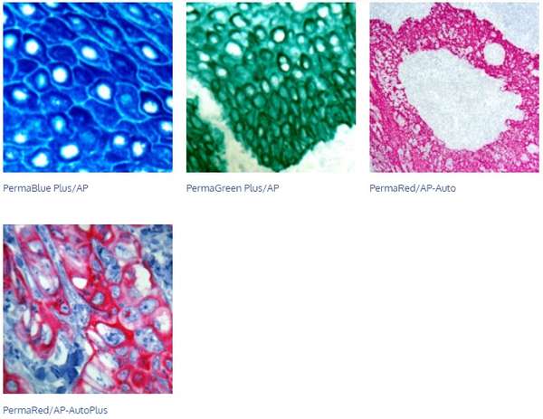 inmunohistoquimica-cromogenos2